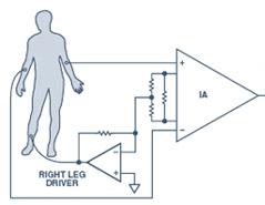 ecg_chain.jpg