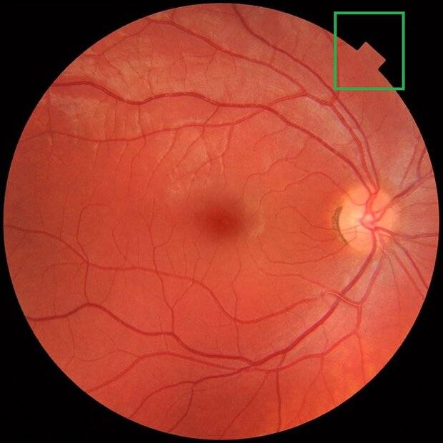 fundus.jpg