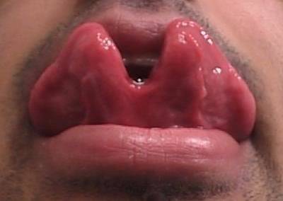 Tongue+Splitting+%25282%2529.jpg