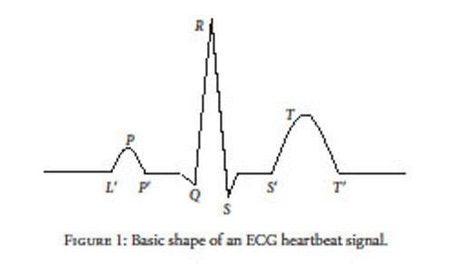 Electrocardiogram (ECG) frequency content