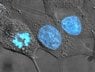 350px-HeLa_cells_stained_with_Hoechst_33258.jpg