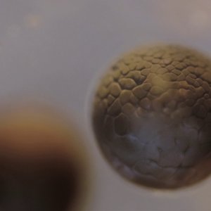 Cell Division Time lapse